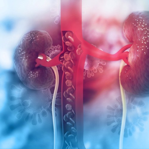 KISS: DOACs and Reduced Renal Function image