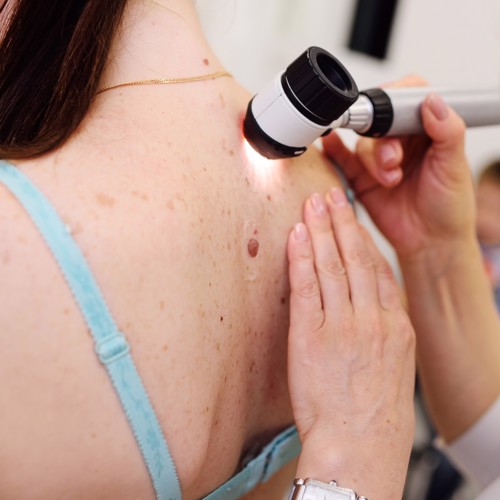When In Doubt, Get the Dermatoscope Out! image
