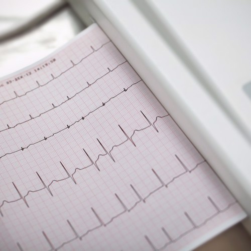 S3 E3 - Rescuing ourselves with a shared vision; funding GP & multimorbidity; empagliflozin for HFpEF; AF - to screen or not to screen image