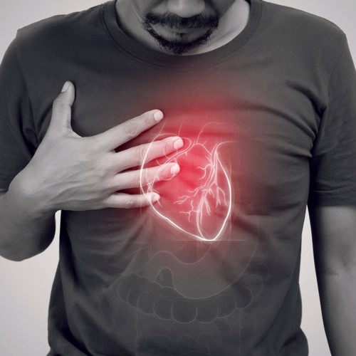 Diagnosing paroxysmal Atrial Fibrillation  image