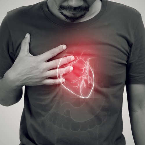 Webinar Image