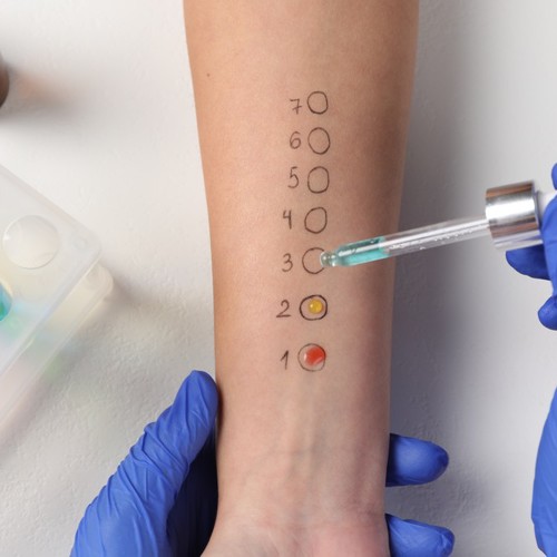 KISS: Allergy Testing in Primary Care image