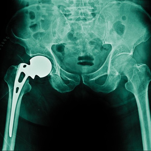 S7 E8: Longevity of THR; GLP1a for Addiction; Analgesia for Kids image