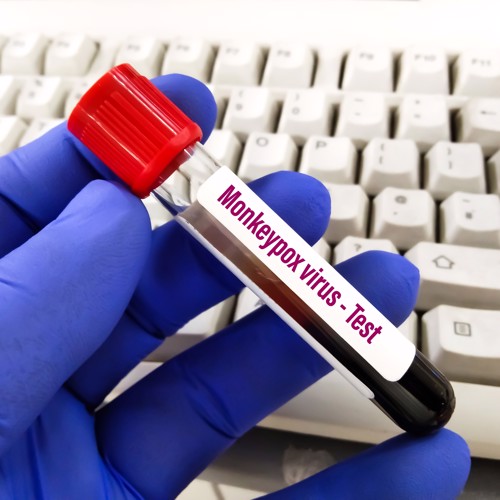 blog image