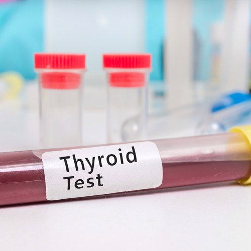 The simple thyroid test? image